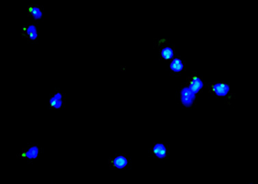 明美MSHOT在CTC循环肿瘤细胞检测