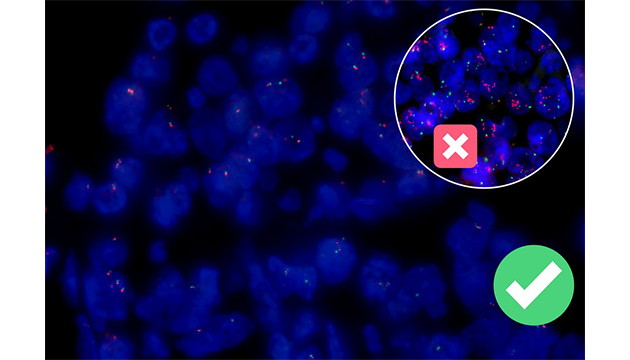 MSHOT荧光原位杂交技术(FISH)的应用