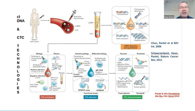 显微镜在CTC循环肿瘤细胞检测