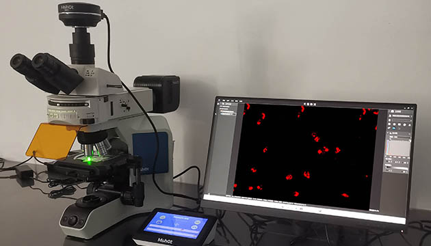 显微镜在CTC循环肿瘤细胞检测