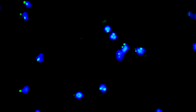 显微镜在CTC循环肿瘤细胞检测